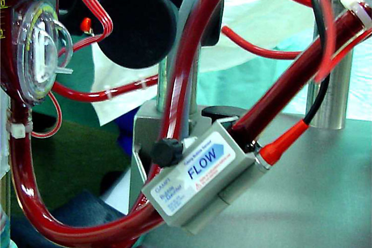 Clamp-on probe in use
