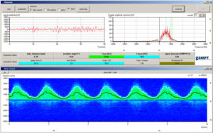 Bildschirmkopie der Software FlowView für Doppler-Untersuchungen
