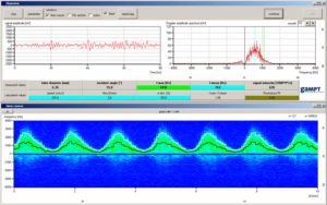 Screenshot of the software FlowView for Doppler measurements