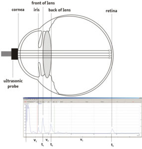 Zuordnung vom Echosignal und Ursprungsort