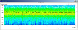 Turbulent blood flow in the region of a stenosis