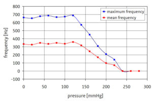 Frequenz-Druck-Diagramm