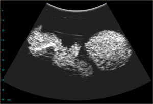 Ultrasound image of the phantom