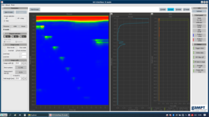 Screenshot of the measuring software in B scan mode