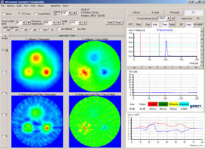Screenshot of the measuring software after CT scan