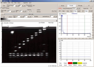 Screenshot of the measuring software (B mode)