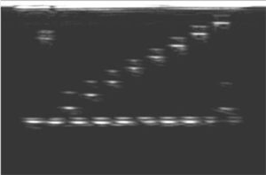 Scan mit 2_MHz-Sonde