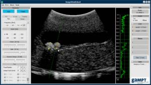 Sonogram gallbladder model