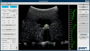 Sonogram gallbladder model